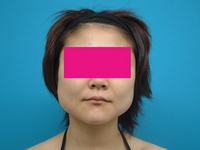 DGP before.jpgのサムネール画像