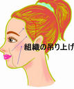 flsuspension_000.jpgのサムネール画像