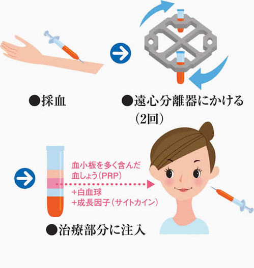 webPRPillust.jpgのサムネール画像